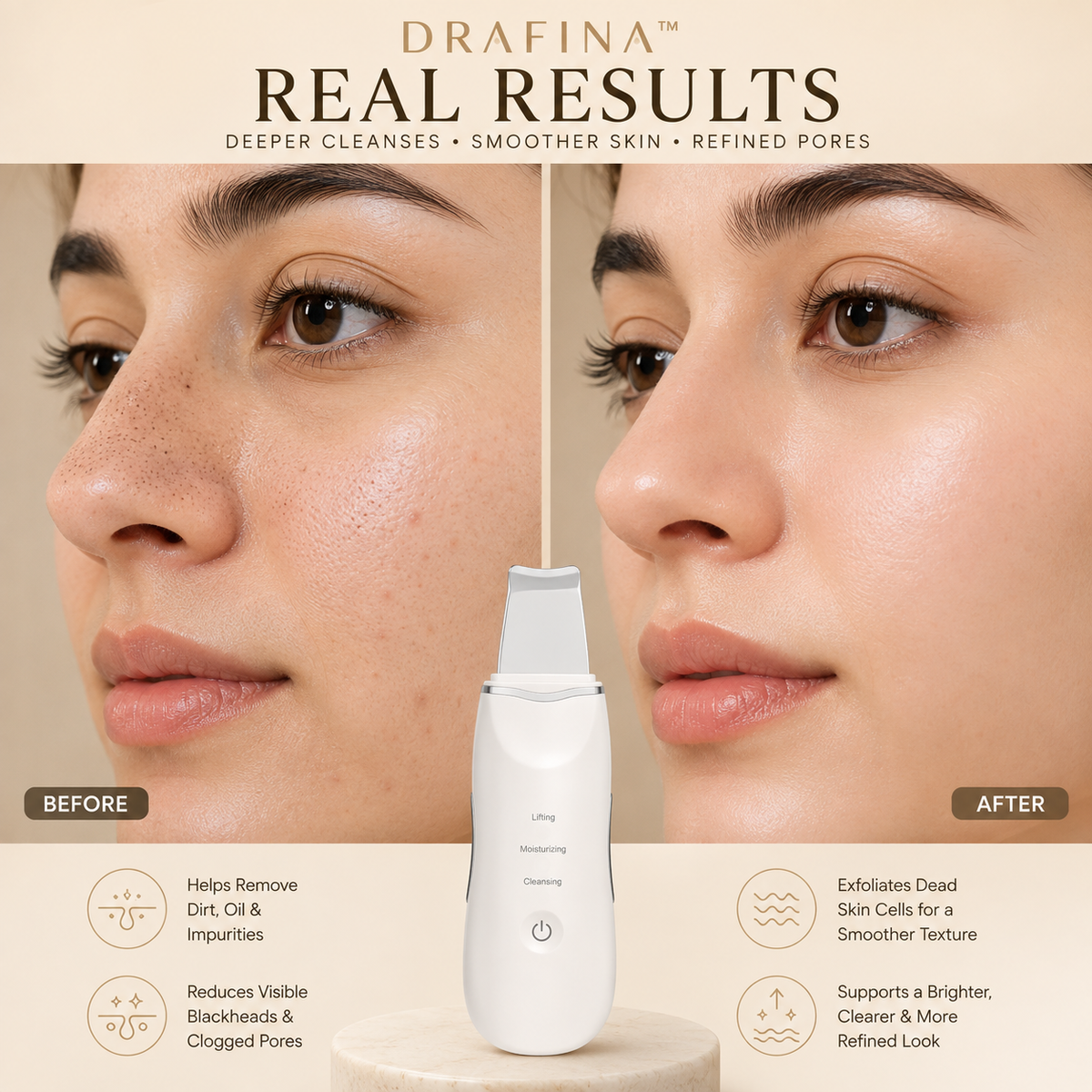 Velisse Ultrasonic Skin Scrubber